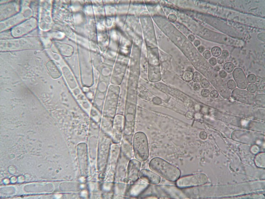 Close-up image of fungal hyphae under microscope showcasing biological structures.